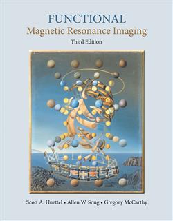 180-day rental: Functional Magnetic Resonance Imaging
