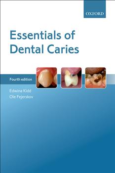 180-day rental: Essentials of Dental Caries